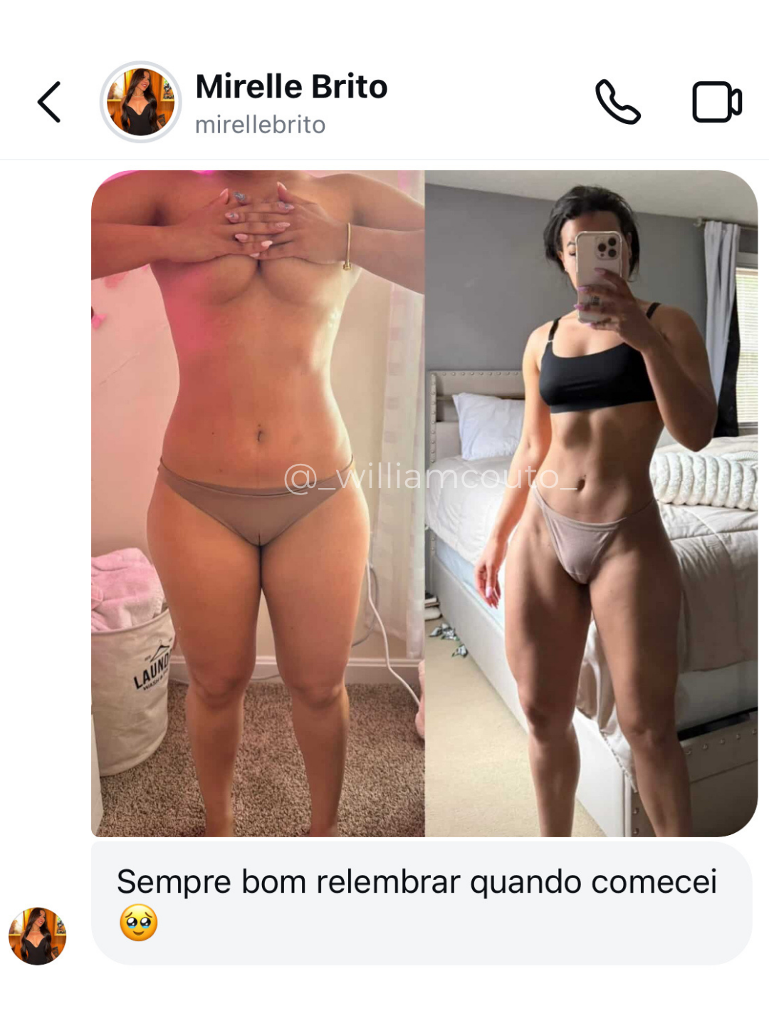 Antes e depois de Mirelle