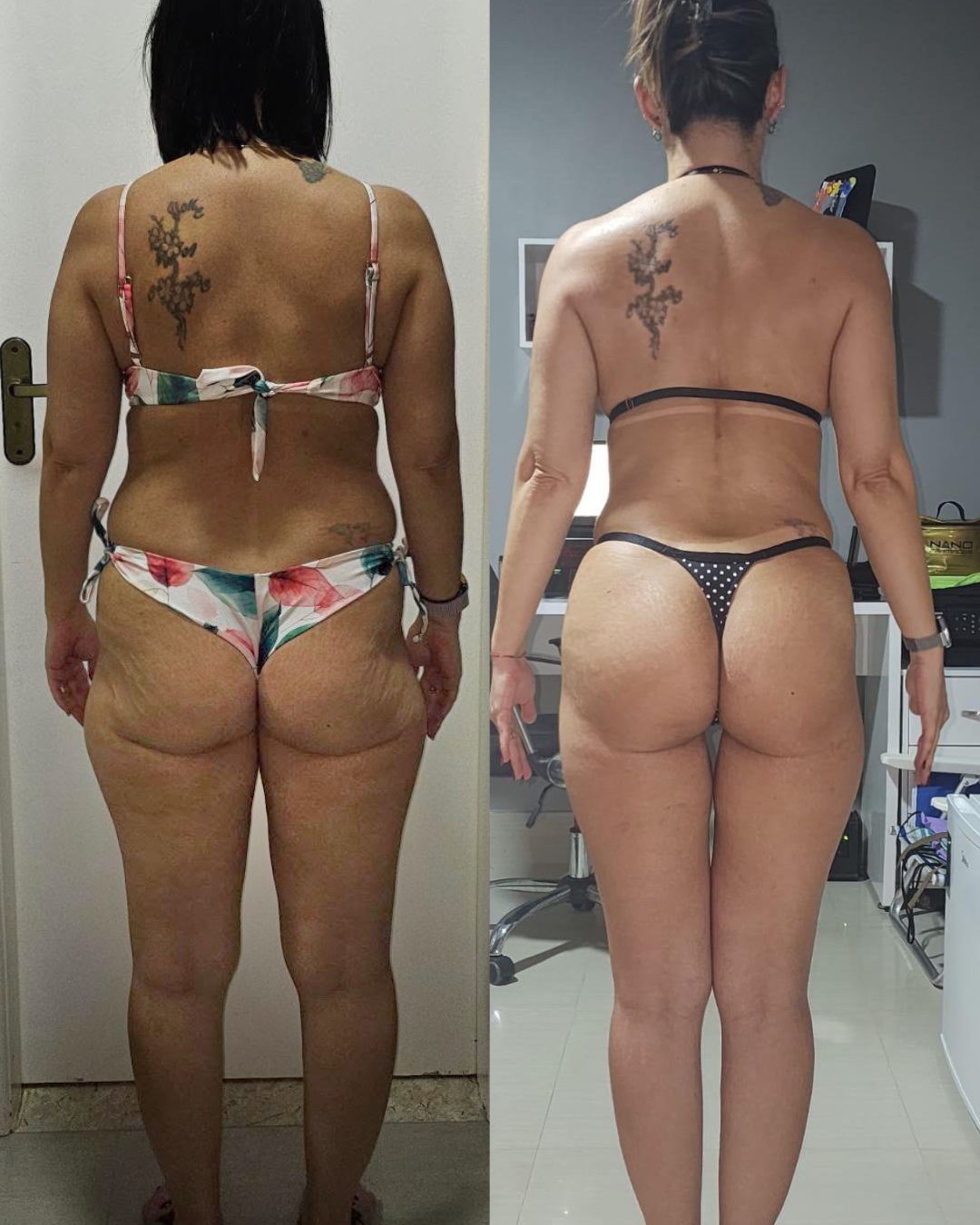 Antes e depois de Dani